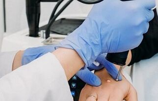 karpų šalinimo būdai